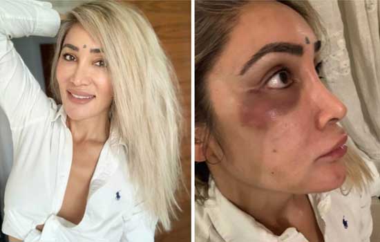 Sofia hayat was physically assaulted